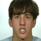 Patient1-before-top1