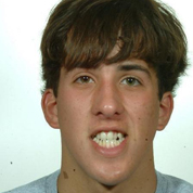 Patient1-before-top2