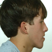 Patient1-before-top3