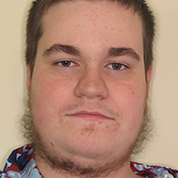 Patient14d-after-top1