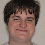 Patient14d-before-top2