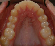 Patient2-before-middle1