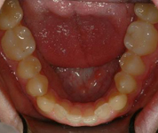 Patient2-before-middle3