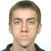 Patient2-before-top1