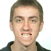 Patient2-before-top2