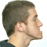 Patient2-before-top3