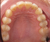 Patient4-before-middle1