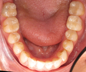 Patient4-before-middle3