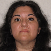 Patient4-before-top1