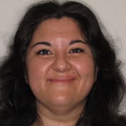 Patient4-before-top2