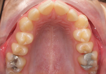 arch-before-05b