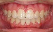 gallery-patient-21c-after-center