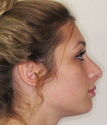 gallery-profile-after-01