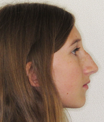 gallery-profile-after-02