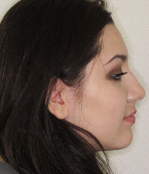 gallery-profile-after-03