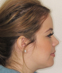 gallery-profile-after-04