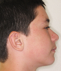 gallery-profile-after-05