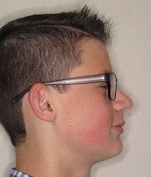 gallery-profile-after-06