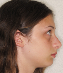 gallery-profile-before-01