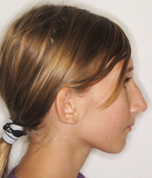 gallery-profile-before-02