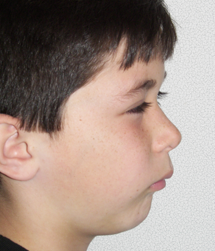 gallery-profile-before-05