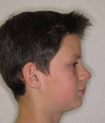 gallery-profile-before-06